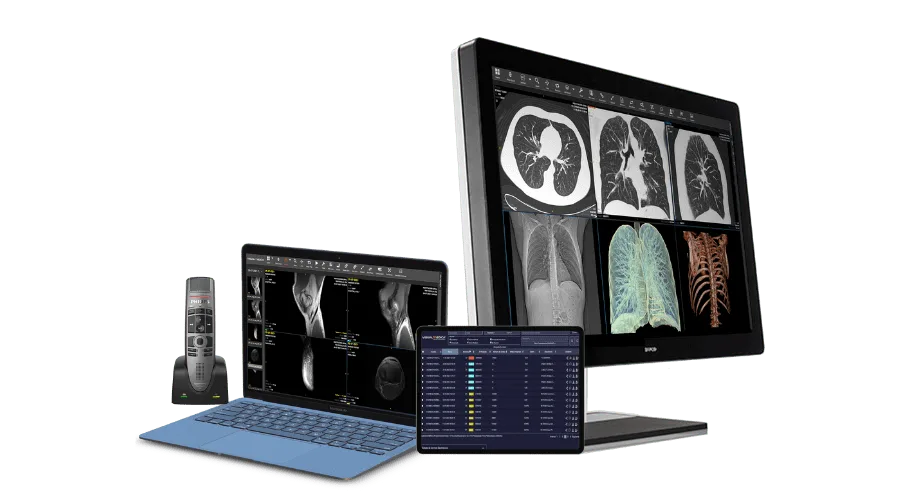 Sistema PACS/RIS VisualMédica